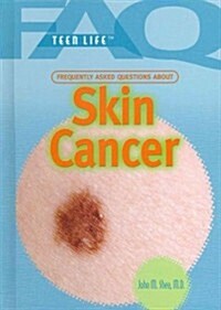 Frequently Asked Questions about Skin Cancer (Library Binding)