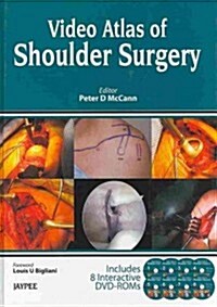 Video Atlas of Shoulder Surgery (Hardcover, 1st, BOX)