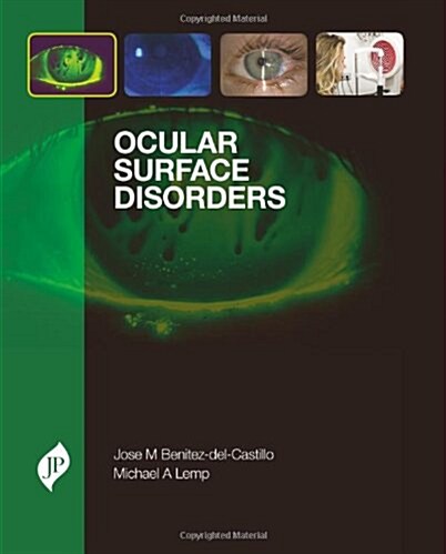 Ocular Surface Disorders (Hardcover, 1st)