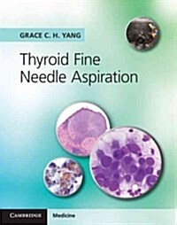 Thyroid Fine Needle Aspiration (Hardcover)