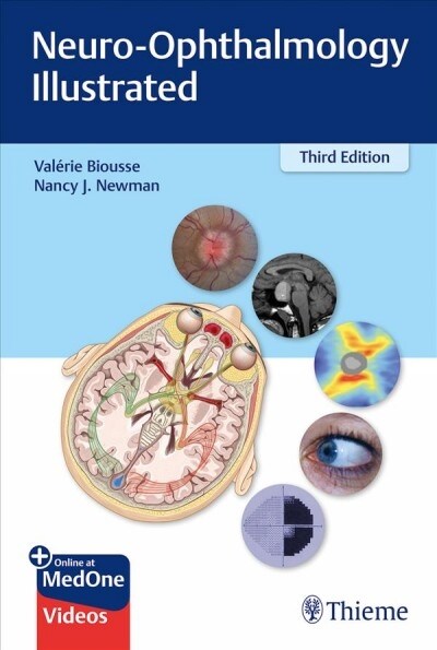 Neuro-Ophthalmology Illustrated (Paperback, 3)