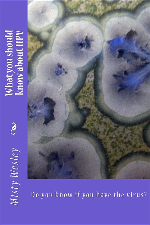 What you should know about HPV: Do you know if you have the virus? (Paperback)