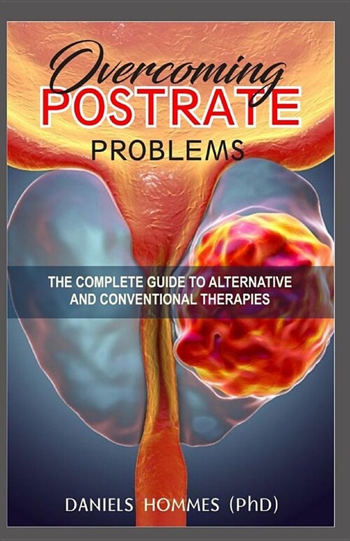 Overcoming Postrate Problem: Essential Guide To Prostate Health (Paperback)