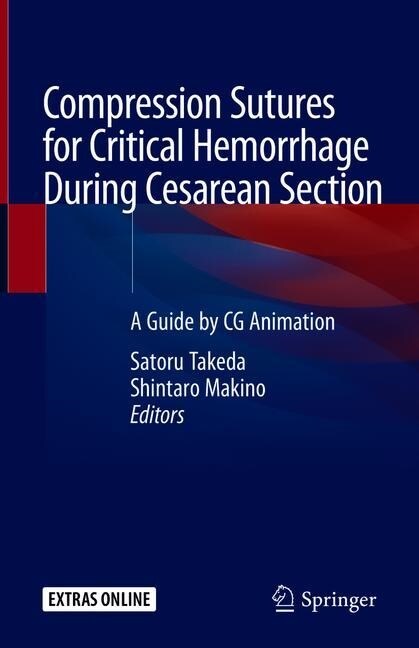 Compression Sutures for Critical Hemorrhage During Cesarean Section: A Guide by CG Animation (Hardcover, 2020)