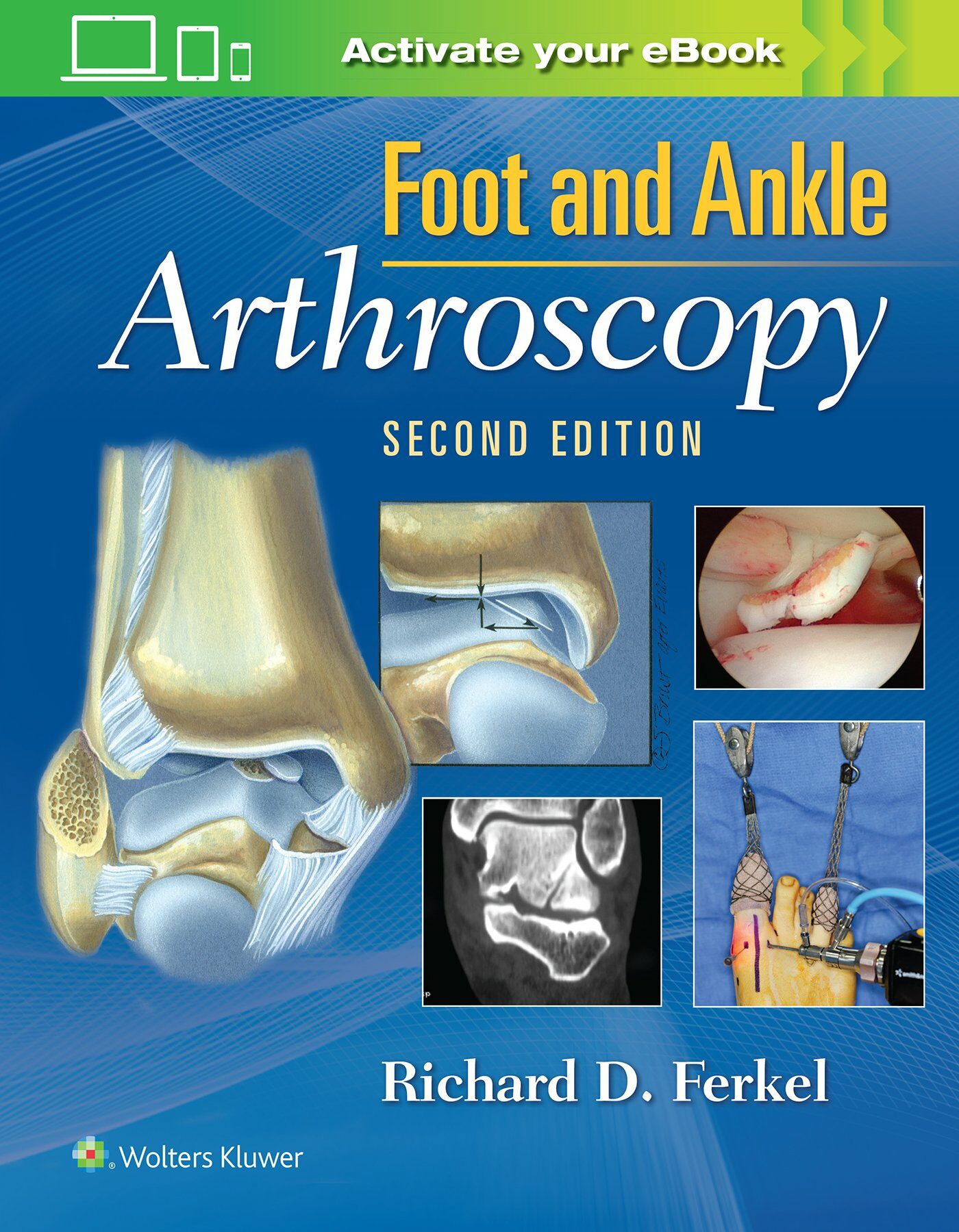 Foot & Ankle Arthroscopy (Hardcover, 2)