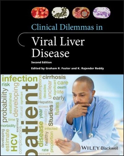 Clinical Dilemmas in Viral Liver Disease (Paperback, 2nd Edition)