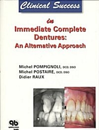 Clinical Success in Immediate Complete Dentures: An Alternative Approach (Paperback)