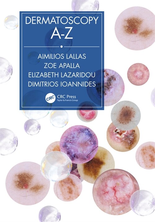 Dermatoscopy A-Z (Hardcover, 1)