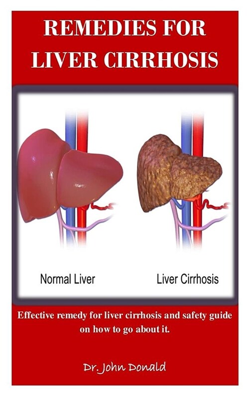 Remedies For Liver Cirrhosis: Effective remedies for liver cirrhosis and safety guide on how to go about it (Paperback)