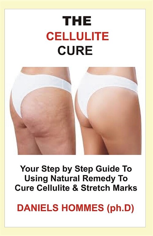 The Cellulite Cure: Step by Step Guide into Using Natural Remedy To Eliminate Cellulite & Erase Stretch Mark (Paperback)