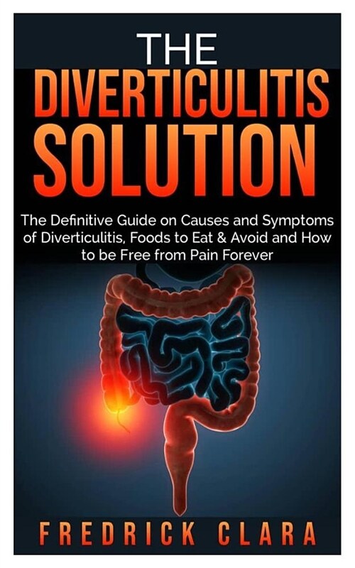 The Diverticulitis Solution: The Definitive Guide on Causes and Symptoms of Diverticulitis, Foods to Eat & Avoid and How to be Free from Pain Forev (Paperback)