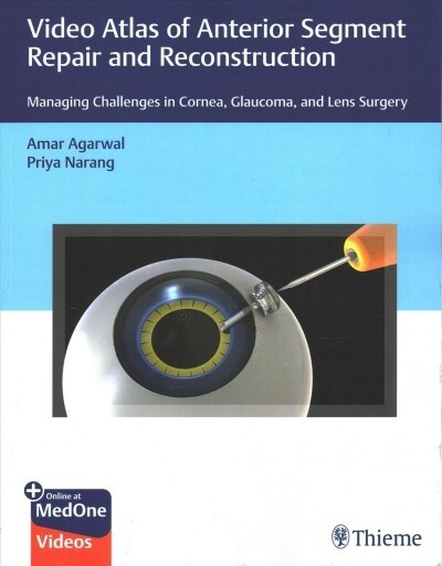 Video Atlas of Anterior Segment Repair and Reconstruction: Managing Challenges in Cornea, Glaucoma, and Lens Surgery (Paperback)