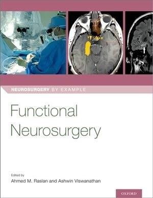 Functional Neurosurgery (Paperback)