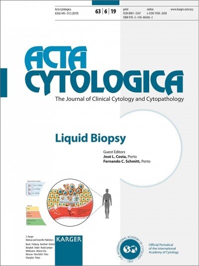 Liquid Biopsy (Paperback)
