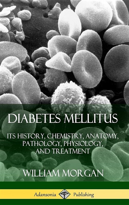 Diabetes Mellitus: Its History, Chemistry, Anatomy, Pathology, Physiology, and Treatment (Hardcover) (Hardcover)