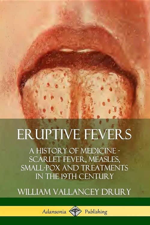 Eruptive Fevers: A History of Medicine - Scarlet Fever, Measles, Small-Pox and Treatments in the 19th Century (Paperback)