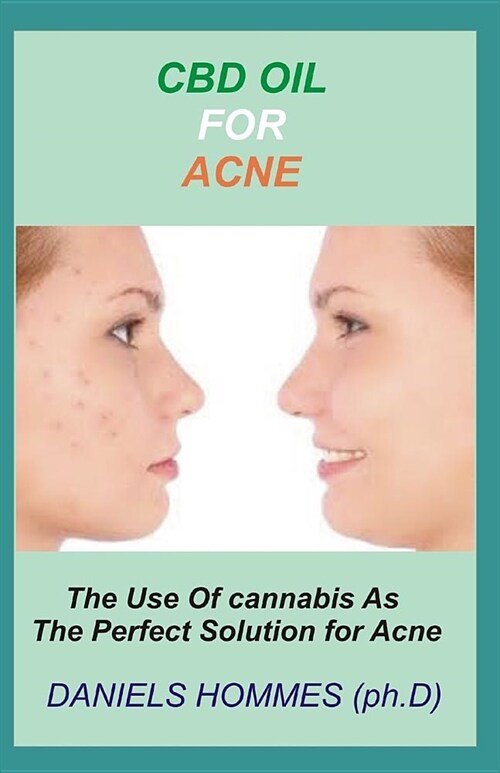 CBD Oil for Acne: Comprehensive Guide on Using CBD Oil to cure Acne Permanently (Paperback)