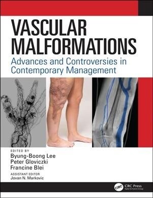 Vascular Malformations : Advances and Controversies in Contemporary Management (Hardcover)