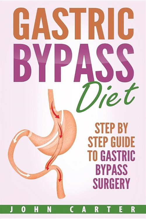 Gastric Bypass Diet: Step By Step Guide to Gastric Bypass Surgery (Paperback)