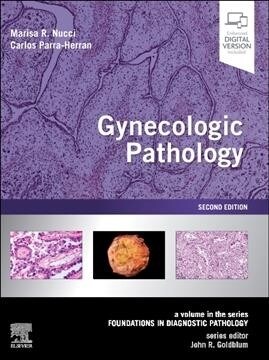 Gynecologic Pathology: A Volume in Foundations in Diagnostic Pathology Series (Hardcover, 2)