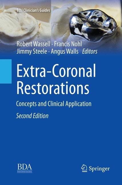 Extra-Coronal Restorations: Concepts and Clinical Application (Paperback, 2, Softcover Repri)