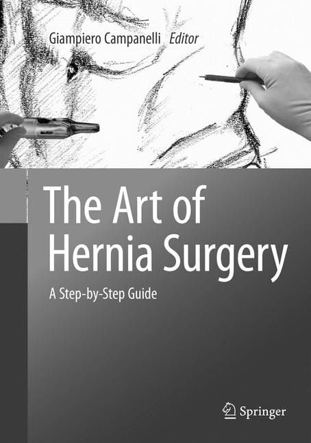 The Art of Hernia Surgery: A Step-By-Step Guide (Paperback, Softcover Repri)