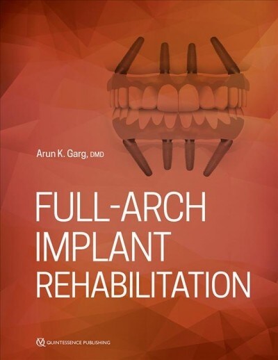 Full-Arch Implant Rehabilitation (Paperback)