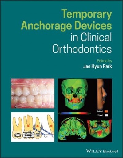 Temporary Anchorage Devices in Clinical Orthodontics (Hardcover, 1st)