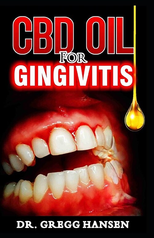 CBD Oil for Gingivitis: Powerful Therapy for Gingivitis Using CBD OIL (Paperback)