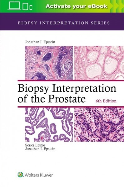 Biopsy Interpretation of the Prostate (Hardcover, 6)