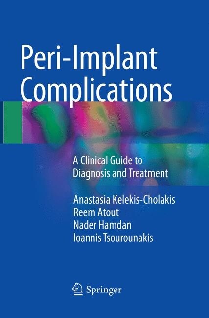 Peri-Implant Complications: A Clinical Guide to Diagnosis and Treatment (Paperback, Softcover Repri)