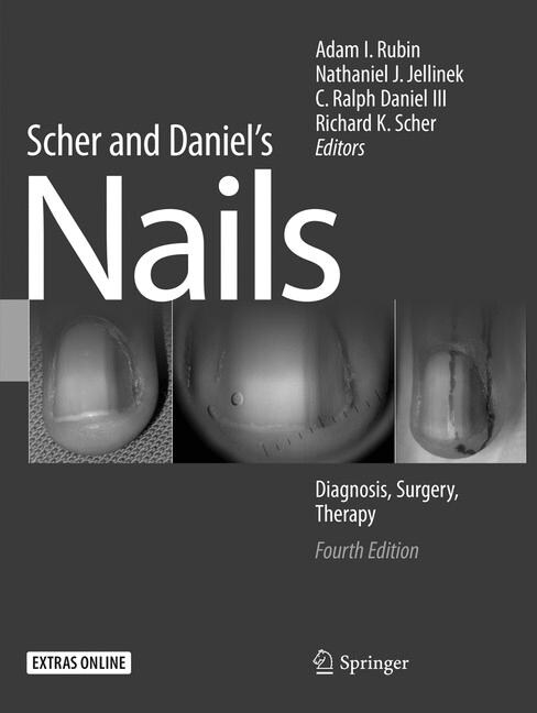 Scher and Daniels Nails: Diagnosis, Surgery, Therapy (Paperback, 4, Softcover Repri)