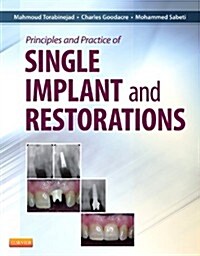 Principles and Practice of Single Implant and Restorations - Pageburst E-book on Vitalsource (Retail Access Card) (Pass Code)