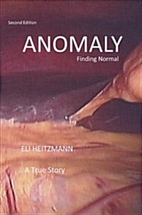 Anomaly: Finding Normal (Paperback, 2)