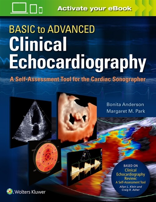 Basic to Advanced Clinical Echocardiography: A Self-Assessment Tool for the Cardiac Sonographer (Paperback)