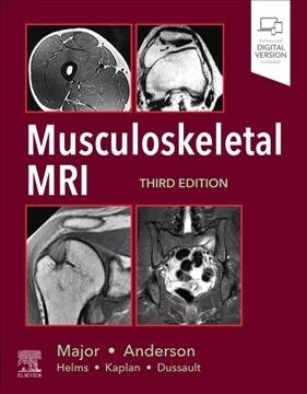 Musculoskeletal MRI (Hardcover)