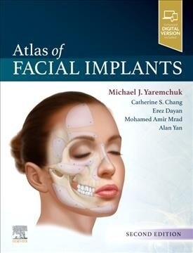 ATLAS OF FACIAL IMPLANTS (Hardcover)