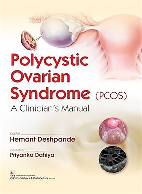 Polycystic Ovarian Syndrome (Pcos): A Clinicians Manual (Paperback)