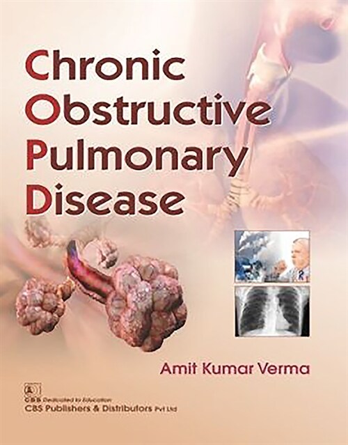 CHRONIC OBSTRUCTIVE PULMONARY DISEASE (Paperback)