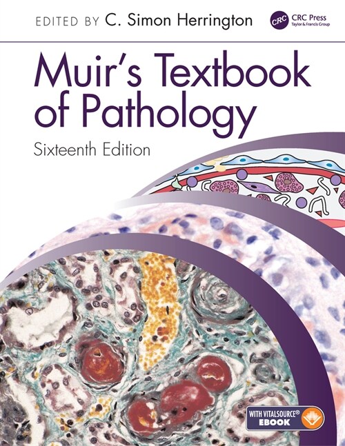 Muirs Textbook of Pathology (Paperback, 16 ed)