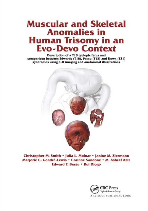 Muscular and Skeletal Anomalies in Human Trisomy in an Evo-Devo Context : Description of a T18 Cyclopic Fetus and Comparison Between Edwards (T18), Pa (Paperback)