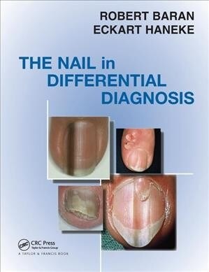 Nail in Differential Diagnosis (Paperback, 1)