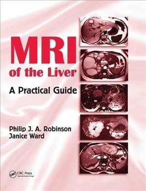 MRI of the Liver : A Practical Guide (Paperback)
