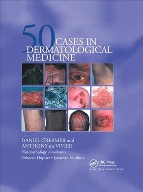 Fifty Dermatological Cases (Paperback, 1)