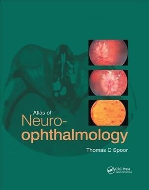 Atlas of Neuro-ophthalmology (Paperback, 1)