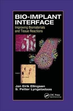 Bio-Implant Interface : Improving Biomaterials and Tissue Reactions (Paperback)