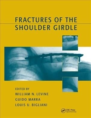 Fractures of the Shoulder Girdle (Paperback, 1)