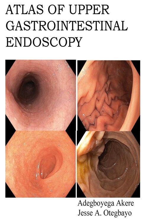 Atlas of Upper Gastrointestinal Endoscopy (Paperback)