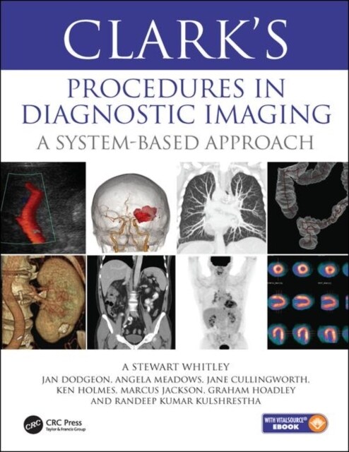 Clark’s Procedures in Diagnostic Imaging : A System-Based Approach (Hardcover)