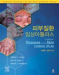 피부질환 임상아틀라스